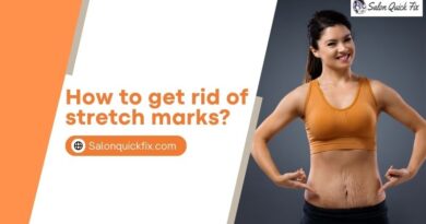 How to get rid of stretch marks?